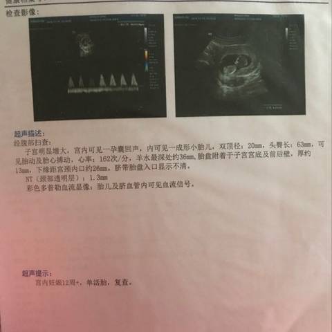journal_insert_pic_1151772323