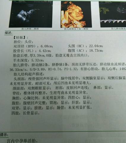 journal_insert_pic_1152001336