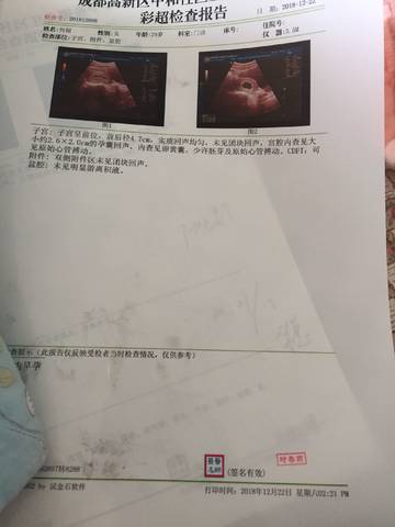 journal_insert_pic_1152417626