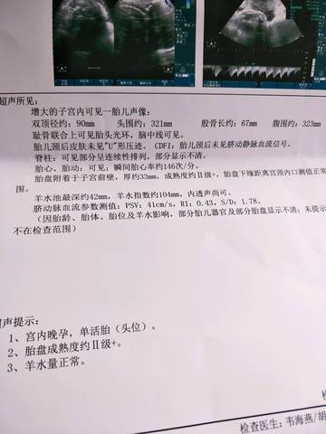 journal_insert_pic_1152928183