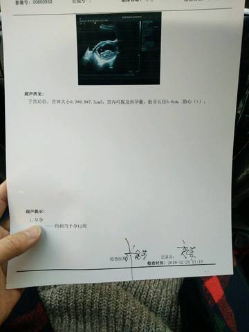 journal_insert_pic_1153996563