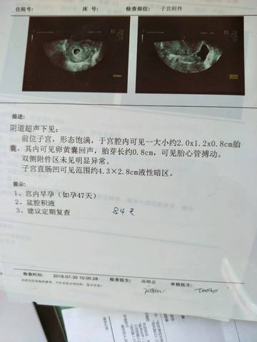 journal_insert_pic_1156024466