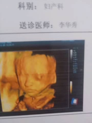 journal_insert_pic_1156526011