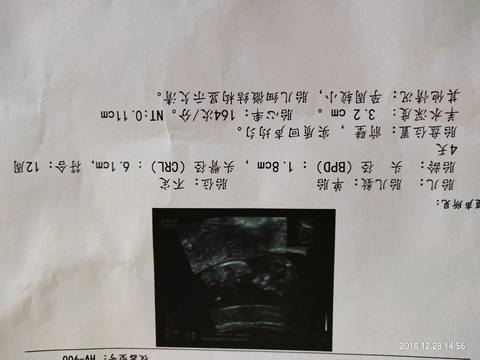 journal_insert_pic_1156840160