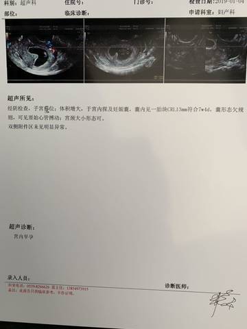 journal_insert_pic_1159755486