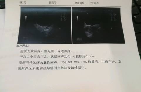 journal_insert_pic_1162079724