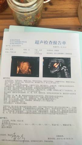 journal_insert_pic_1162531464