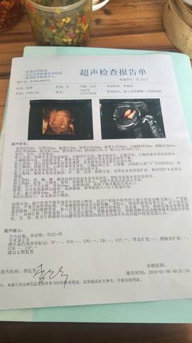 journal_insert_pic_1162531455