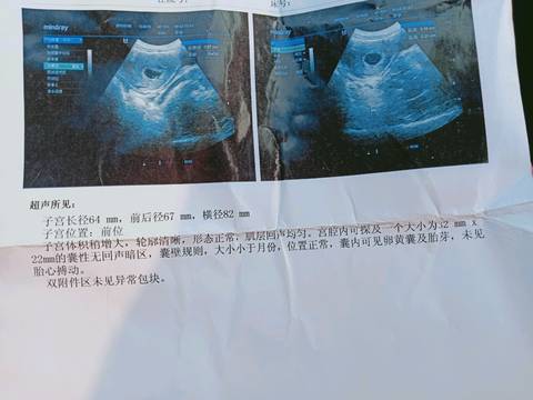 journal_insert_pic_1163066960