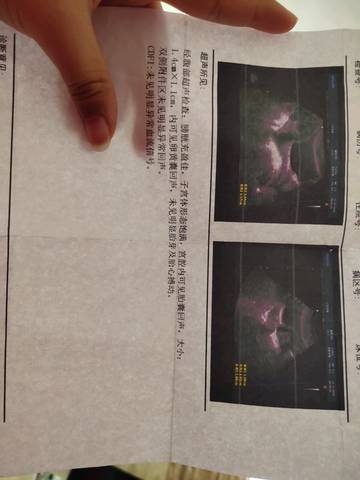 journal_insert_pic_1164038371