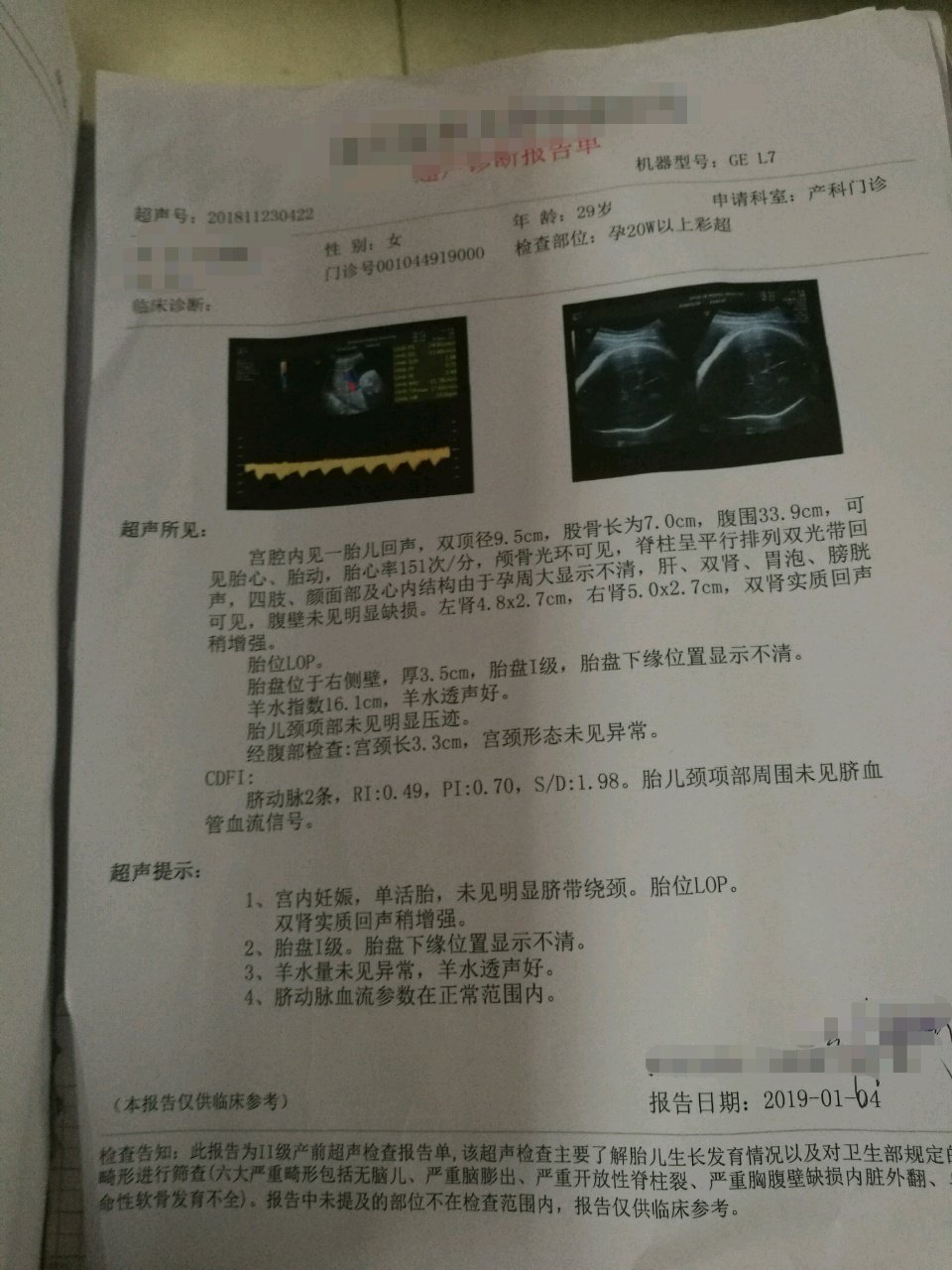 孕晚期双肾实质回声稍增强
