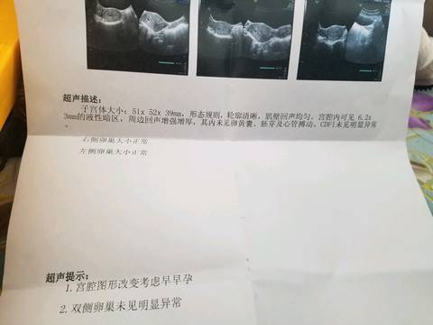 journal_insert_pic_1166707841