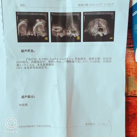 journal_insert_pic_1167424586