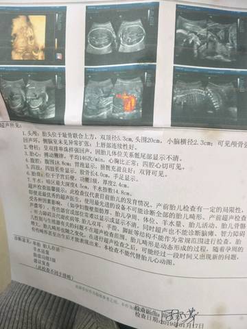journal_insert_pic_1167496268