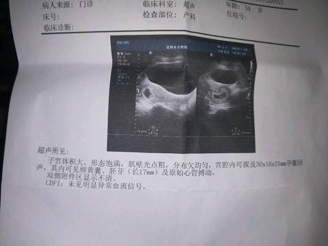 journal_insert_pic_1167943733