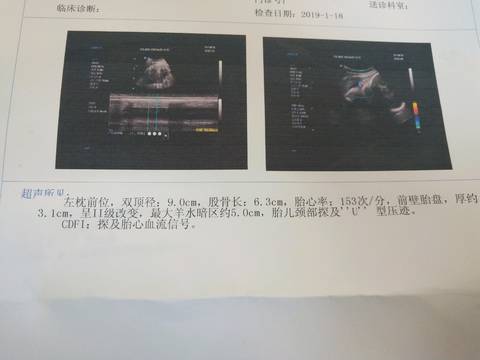 journal_insert_pic_1168650784