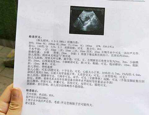 journal_insert_pic_1170442086