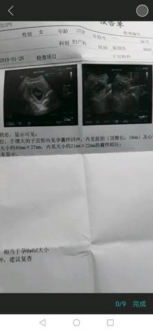 journal_insert_pic_1172290067
