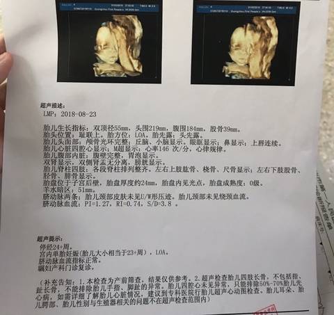 journal_insert_pic_1172950522