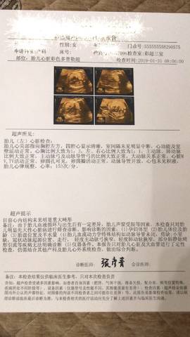 journal_insert_pic_1174093152