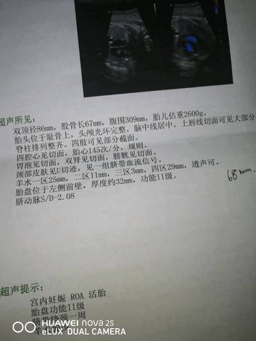 journal_insert_pic_1177587256