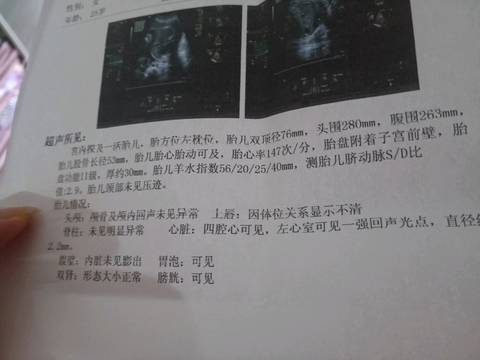 journal_insert_pic_1177901451