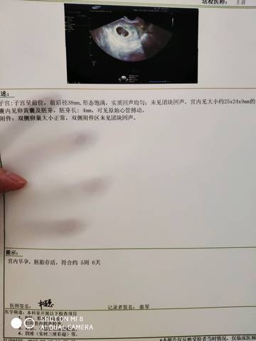 journal_insert_pic_1179519462