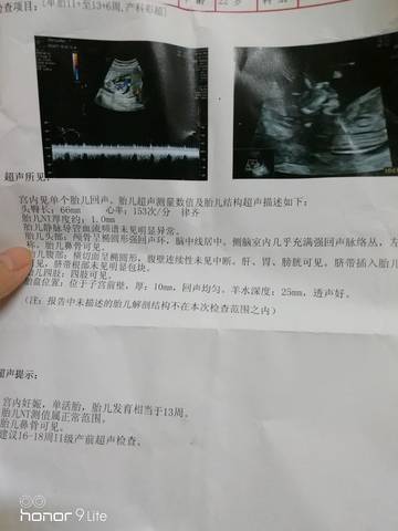 journal_insert_pic_1180424917
