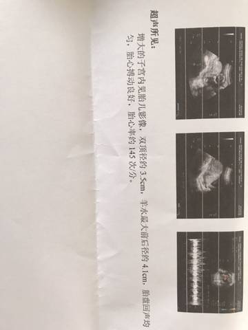 journal_insert_pic_1180149016