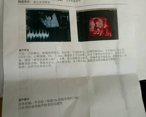 journal_insert_pic_1180677315