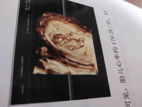 journal_insert_pic_1181637117