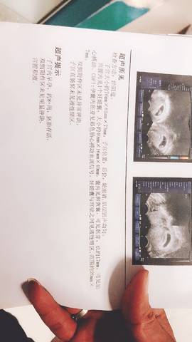 journal_insert_pic_1182420058