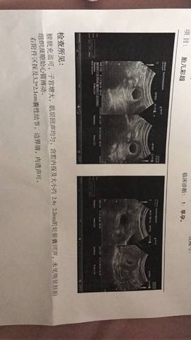 journal_insert_pic_1185198770