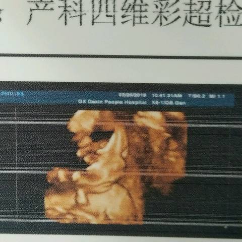 journal_insert_pic_1189241046