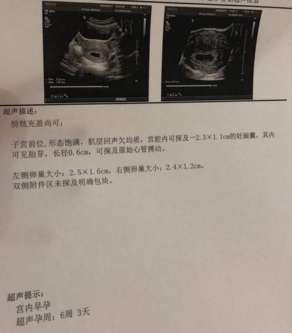 journal_insert_pic_1190621145