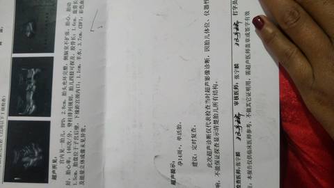 journal_insert_pic_1192935533