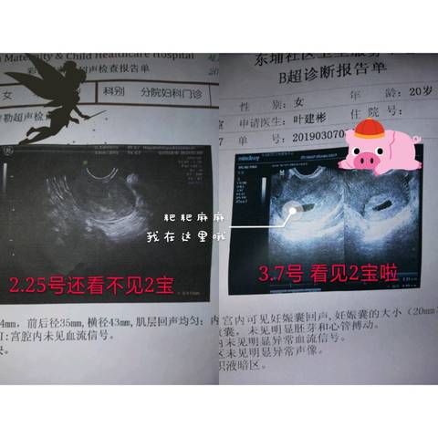 journal_insert_pic_1194324744
