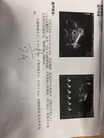 journal_insert_pic_1196063828