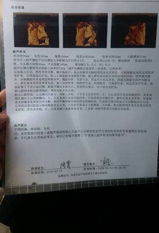 journal_insert_pic_1196382106