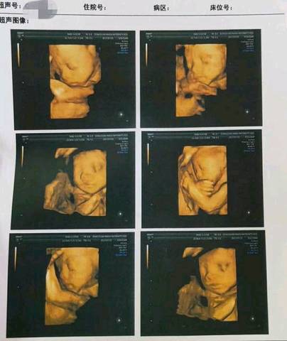 journal_insert_pic_1197055806