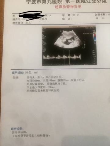 journal_insert_pic_1197724626