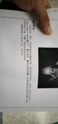 journal_insert_pic_1200559790
