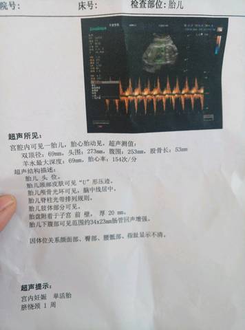 journal_insert_pic_1200893789