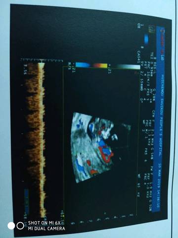 journal_insert_pic_1204082673