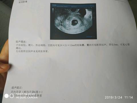 journal_insert_pic_1203701225
