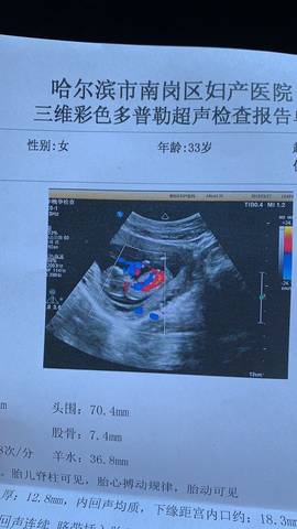journal_insert_pic_1205450592