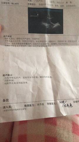 journal_insert_pic_1205485710