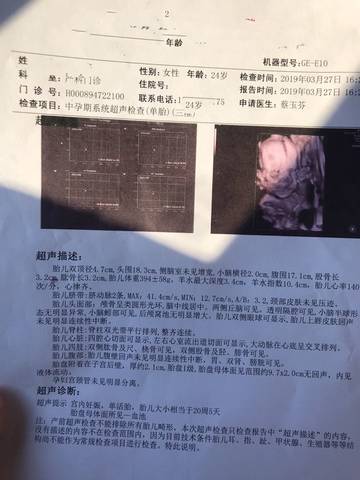 journal_insert_pic_1205790618