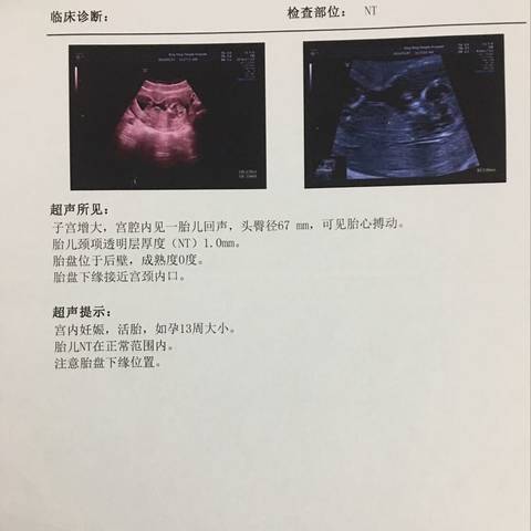 journal_insert_pic_1206629160