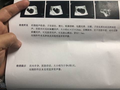journal_insert_pic_1206850489